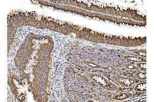 IHC analysis of PDIA5 using anti-PDIA5 antibody (ABIN7601801).