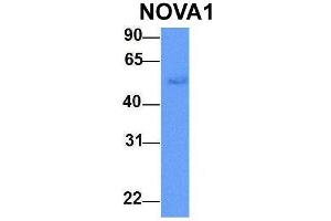 Host:  Rabbit  Target Name:  NOVA1  Sample Type:  Human Adult Placenta  Antibody Dilution:  1. (NOVA1 anticorps  (C-Term))