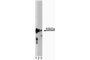 Western blot analysis of Synaptotagmin on rat brain lysate. (Synaptotagmin anticorps  (AA 72-223))