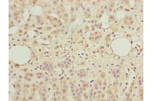 Immunohistochemistry of paraffin-embedded human adrenal gland tissue using ABIN7171598 at dilution of 1:100 (TBC1D14 anticorps  (AA 136-435))