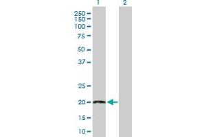 Western Blot analysis of TWIST2 expression in transfected 293T cell line by TWIST2 MaxPab polyclonal antibody. (TWIST2 anticorps  (AA 1-160))
