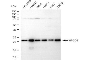 Western blotting analysis using HPGDS antibody (ABIN7798881).