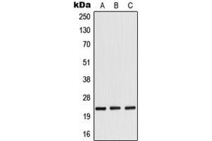 Western blot analysis of RANBP1 expression in HeLa (A), mouse brain (B), rat brain (C) whole cell lysates. (RANBP1 anticorps  (Center))
