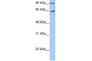 Transfected 293T; WB Suggested Anti-ZNF449 Antibody Titration: 0. (ZNF449 anticorps  (C-Term))
