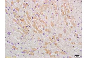 Formalin-fixed and paraffin embedded mouse heart labeled with Rabbit Anti-GLUT12 Polyclonal Antibody, Unconjugated (ABIN741765) at 1:200, followed by conjugation to the secondary antibody and DAB staining (GLUT12 anticorps  (AA 251-350))