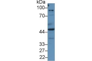 Detection of PRAME in Human A549 cell lysate using Polyclonal Antibody to Preferentially Expressed Antigen In Melanoma (PRAME) (PRAME anticorps  (AA 416-502))