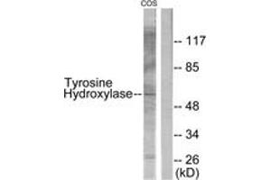 Western blot analysis of extracts from COS7, using Tyrosine Hydroxylase (Ab-31) Antibody. (Tyrosine Hydroxylase anticorps  (AA 1-50))