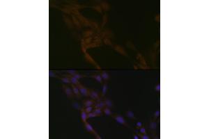 Immunofluorescence analysis of NIH-3T3 cells using SMURF2 Rabbit mAb (ABIN1680578, ABIN3015927, ABIN3015928 and ABIN7101462) at dilution of 1:100 (40x lens).