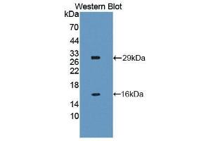 Western Blotting (WB) image for anti-NLR Family, Apoptosis Inhibitory Protein (NAIP) (AA 500-759) antibody (ABIN1859963) (NAIP anticorps  (AA 500-759))