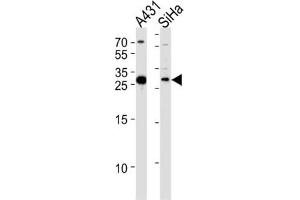 Western Blotting (WB) image for anti-Hydroxysteroid (17-Beta) Dehydrogenase 12 (HSD17B12) antibody (ABIN3004142)