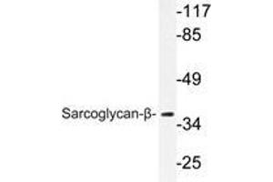 Western blot analysis of Sarcoglycan-β antibody in extracts from A549 cells. (SGCB anticorps)