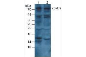 Rabbit Detection antibody from the kit in WB with Positive Control:  Sample Human lung tissue.