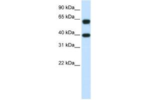 WB Suggested Anti-NXF3 Antibody Titration:  1. (NXF3 anticorps  (C-Term))
