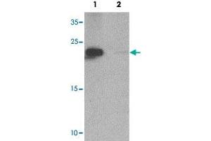 Western blot analysis of NIH/3T3 cell tissue lysate with ZFYVE21 polyclonal antibody  at 1 ug/mL in (1) the absence and (2) the presence of blocking peptide. (ZFYVE21 anticorps  (N-Term))