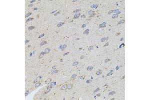 Immunohistochemistry of paraffin-embedded rat brain using ALDH1A1 antibody.