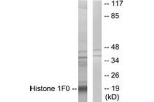 Western blot analysis of extracts from A549 cells, using Histone 1F0 Antibody. (Histone H1 anticorps  (AA 71-120))