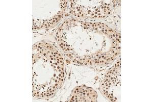 (ABIN1538275 and ABIN2849896) staining ALKBH5 in human testis tissue sections by Immunohistochemistry (IHC-P - paraformaldehyde-fixed, paraffin-embedded sections). (ALKBH5 anticorps  (AA 302-330))
