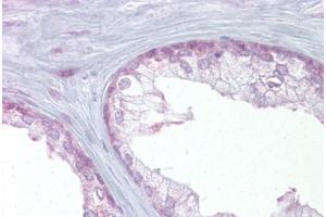 Immunohistochemical staining (Formalin-fixed paraffin-embedded sections) of human prostate with EDF1 polyclonal antibody . (EDF1 anticorps  (AA 99-148))