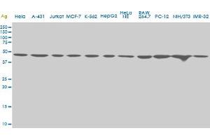 USF2 monoclonal antibody (M03), clone 6A9. (USF2 anticorps  (AA 1-100))