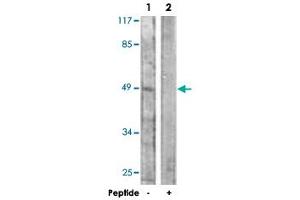 Western blot analysis of extracts from HeLa cells, using KCNJ16 polyclonal antibody .