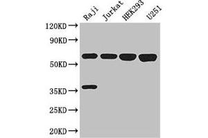 Western Blot Positive WB detected in: Raji whole cell lysate, Jurkat whole cell lysate, HEK293 whole cell lysate, U251 whole cell lysate All lanes: KPNA2 antibody at 3 μg/mL Secondary Goat polyclonal to rabbit IgG at 1/50000 dilution Predicted band size: 58 kDa Observed band size: 58 kDa (KPNA2 anticorps  (AA 2-285))