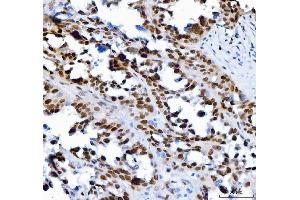 IHC analysis of SP1 using anti-SP1 antibody (ABIN7601559).