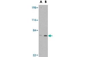 Western blot analysis of LRFN5 in EL4 cell lysate with LRFN5 polyclonal antibody  at (A) 0. (LRFN5 anticorps  (C-Term))