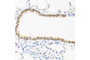 Immunohistochemistry of paraffin-embedded rat lung using CDKN2C antibody (ABIN5971074) at dilution of 1/100 (40x lens). (CDKN2C anticorps)