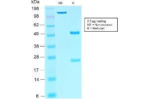 SDS-PAGE Analysis Purified SOX10-Monospecific Recombinant Mouse Monoclonal Antibody (rSOX10/1074).
