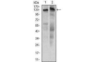 Western blot analysis using KIAA1967 mouse mAb against HeLa (1) and HepG2 (2) cell lysate.
