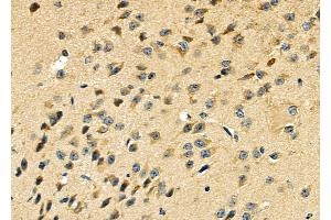 ABIN6264833 and ABIN6279044 at 1/100 staining Mouse brain tissue by IHC-P. (RPL29 anticorps  (Internal Region))
