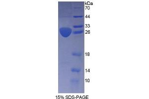 SDS-PAGE analysis of Human ARNT2 Protein. (ARNT2 Protéine)