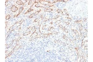 Formalin-fixed, paraffin-embedded human Spleen stained with VEGI Rabbit Recombinant Monoclonal Antibody (VEGI /2052R).