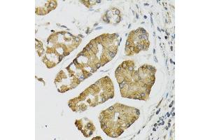 Immunohistochemistry of paraffin-embedded human esophagus using PI3 antibody (ABIN6293676) at dilution of 1:100 (40x lens). (PI3 anticorps)
