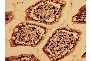 Immunohistochemistry of paraffin-embedded human small intestine tissue using ABIN7175485 at dilution of 1:100