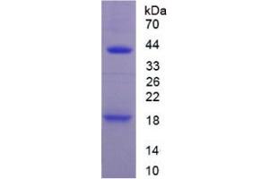 SDS-PAGE analysis of Mouse IL1R1 Protein. (IL1R1 Protéine)