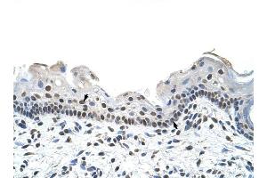 RBM28 antibody was used for immunohistochemistry at a concentration of 4-8 ug/ml to stain Squamous epithelial cells (arrows) in Human Skin. (RBM28 anticorps  (C-Term))