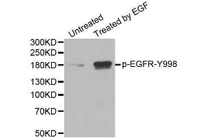 Western Blotting (WB) image for anti-Epidermal Growth Factor Receptor (EGFR) (pTyr1016) antibody (ABIN1870114) (EGFR anticorps  (pTyr1016))