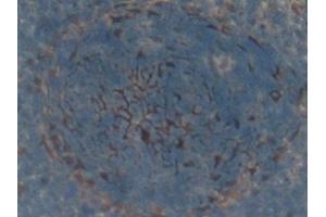 Detection of FAS in Rat Spleen Tissue using Polyclonal Antibody to Factor Related Apoptosis (FAS) (FAS anticorps  (AA 21-170))