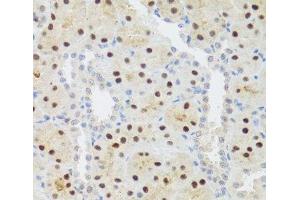 Immunohistochemistry of paraffin-embedded Rat kidney using STAT4 Polyclonal Antibody at dilution of 1:100 (40x lens). (STAT4 anticorps)