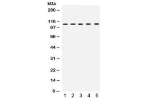 Western blot testing of 1) rat testis, 2) rat ovary, 3) human SKOV, 4) COLO320 and 5) human HeLa lysate with TRIM28 antibody. (KAP1 anticorps  (AA 699-835))