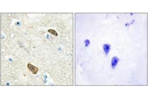 Immunohistochemistry analysis of paraffin-embedded human brain, using PLXDC1 Antibody. (PLXDC1 anticorps  (AA 71-120))