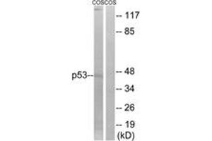 Western blot analysis of extracts from COS7 cells, treated with UV, using p53 (Ab-9) Antibody. (p53 anticorps  (AA 8-57))
