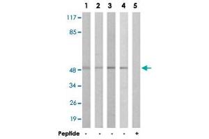 Western blot analysis of extracts from COLO cells (Lane 1 and 5), HT-29 cells (Lane 2), A-549 cells (Lane 3) and 293 cells (Lane 4), using IL13RA1 polyclonal antibody . (IL13 Receptor alpha 1 anticorps)