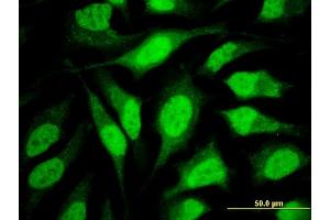 Immunofluorescence of monoclonal antibody to WDR42A on HeLa cell.