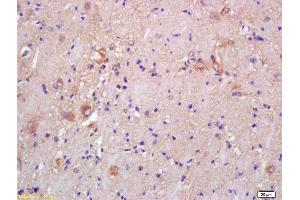 Formalin-fixed and paraffin embedded rat brain labeled with Rabbit Anti CKMT/Creatine kinase MT Polyclonal Antibody, Unconjugated (ABIN717536) at 1:200 followed by conjugation to the secondary antibody and DAB staining (CKMT1B anticorps  (AA 115-220))