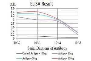 Black line: Control Antigen (100 ng),Purple line: Antigen (10 ng), Blue line: Antigen (50 ng), Red line:Antigen (100 ng)