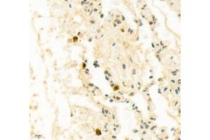 Immunohistochemistry of paraffin embedded human lung using SIX1 (ABIN7075617) at dilution of 1: 650 (400x lens) (SIX Homeobox 1 anticorps)
