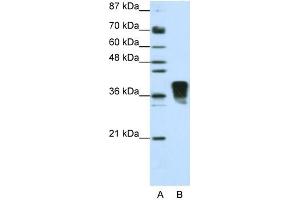 WB Suggested Anti-SFRS10 Antibody Titration:  1. (TRA2B anticorps  (N-Term))