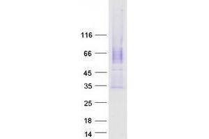 Validation with Western Blot